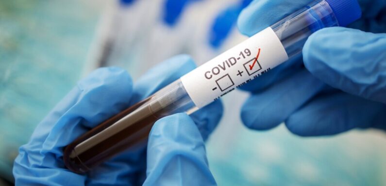🔴 За тиждень на Ямпільщині на COVID-19 захворіло 57 людей, у 58 виявили ГРВІ